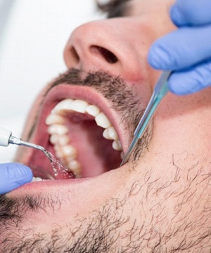 man getting dental exam