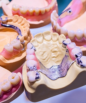 partial dentures sitting on a model of a mouth
