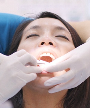 A dental professional performing scaling and root planing on a patient with aggressive gum disease