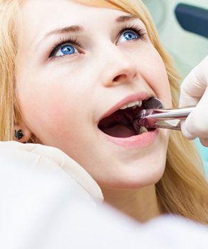 A dentist performing a wisdom tooth extraction