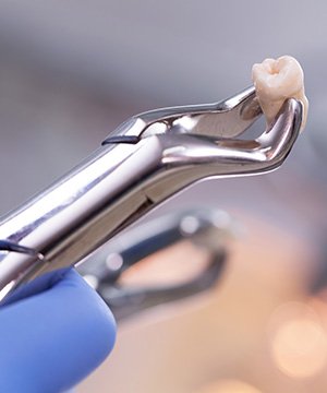 Dental forceps holding an extracted wisdom tooth