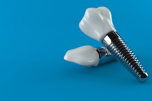 Dental implant lying on top of another one